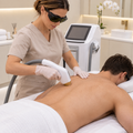 Chest & Back Patch Laser Package – 6 Sessions