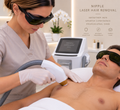 Nipple Laser Hair Removal