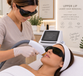 Upper Lip Laser Hair Removal